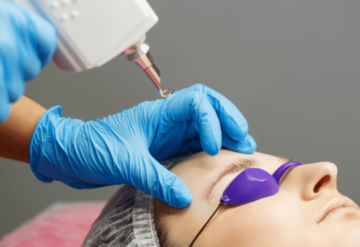 Kaş Silme Eğitimi